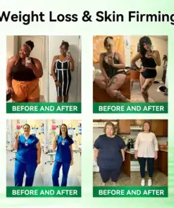 𝐏𝐮𝐫𝐞𝐥𝐨𝐫𝐚® 𝐁𝐞𝐫𝐛𝐞𝐫𝐢𝐧𝐞 𝟖-𝐈𝐍-𝟏 𝐒𝐥𝐢𝐦 & 𝐇𝐞𝐚𝐥𝐭𝐡𝐲 𝐒𝐞𝐫𝐮𝐦 𝐍𝐚𝐧𝐨 𝐌𝐢𝐜𝐫𝐨𝐧𝐞𝐞𝐝𝐥𝐞 𝐏𝐚𝐭𝐜𝐡