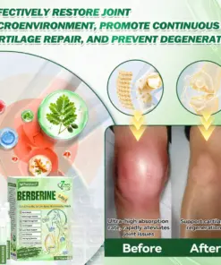 𝐏𝐮𝐫𝐞𝐥𝐨𝐫𝐚® 𝐁𝐞𝐫𝐛𝐞𝐫𝐢𝐧𝐞 𝟖-𝐈𝐍-𝟏 𝐒𝐥𝐢𝐦 & 𝐇𝐞𝐚𝐥𝐭𝐡𝐲 𝐒𝐞𝐫𝐮𝐦 𝐍𝐚𝐧𝐨 𝐌𝐢𝐜𝐫𝐨𝐧𝐞𝐞𝐝𝐥𝐞 𝐏𝐚𝐭𝐜𝐡