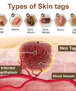 𝑷𝒖𝒓𝒆𝒍𝒐𝒓𝒂® 𝑩𝒍𝒂𝒄𝒌 & 𝑾𝒉𝒊𝒕𝒆 𝑹𝒊𝒄𝒆 𝑫𝒖𝒂𝒍 𝑹𝒆𝒏𝒆𝒘𝒂𝒍 𝑪𝒓𝒆𝒂𝒎