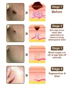 𝑷𝒖𝒓𝒆𝒍𝒐𝒓𝒂® 𝑩𝒍𝒂𝒄𝒌 & 𝑾𝒉𝒊𝒕𝒆 𝑹𝒊𝒄𝒆 𝑫𝒖𝒂𝒍 𝑹𝒆𝒏𝒆𝒘𝒂𝒍 𝑪𝒓𝒆𝒂𝒎