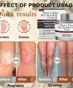 𝑷𝒖𝒓𝒆𝒍𝒐𝒓𝒂® 𝑩𝒍𝒂𝒄𝒌 & 𝑾𝒉𝒊𝒕𝒆 𝑹𝒊𝒄𝒆 𝑫𝒖𝒂𝒍 𝑹𝒆𝒏𝒆𝒘𝒂𝒍 𝑪𝒓𝒆𝒂𝒎