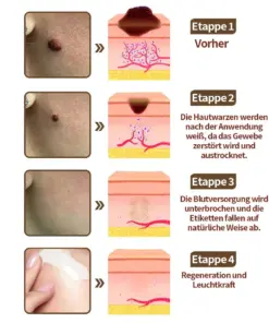 𝑷𝒖𝒓𝒆𝒍𝒐𝒓𝒂® 𝑺𝒄𝒉𝒘𝒂𝒓𝒛 & 𝑾𝒆𝒊𝒔𝒔 𝑹𝒆𝒊𝒔 𝑫𝒖𝒂𝒍-𝑹𝒆𝒏𝒆𝒘𝒂𝒍 𝑪𝒓𝒆𝒎𝒆