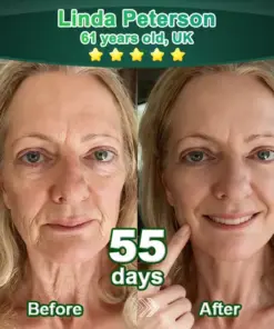 𝗣𝘂𝗿𝗲𝗹𝗼𝗿𝗮® 𝗦𝘁𝗲𝗺 𝗖𝗲𝗹𝗹–𝗔𝗰𝘁𝗶𝘃𝗮𝘁𝗲𝗱 𝗖𝗼𝗹𝗹𝗮𝗴𝗲𝗻 𝗣𝗲𝗽𝘁𝗶𝗱𝗲 𝗱𝗿𝗼𝗽𝘀