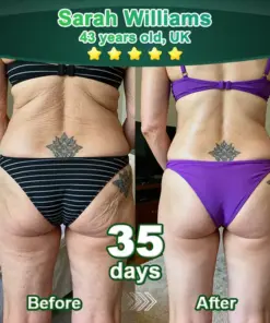 𝗣𝘂𝗿𝗲𝗹𝗼𝗿𝗮® 𝗦𝘁𝗲𝗺 𝗖𝗲𝗹𝗹–𝗔𝗰𝘁𝗶𝘃𝗮𝘁𝗲𝗱 𝗖𝗼𝗹𝗹𝗮𝗴𝗲𝗻 𝗣𝗲𝗽𝘁𝗶𝗱𝗲 𝗱𝗿𝗼𝗽𝘀