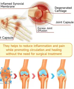 Purelora® BEE VENOM LITHOSPERMUM Pain-Relief Bone Healing Cream