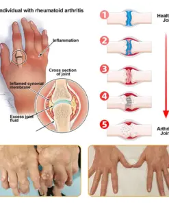 Purelora® BEE VENOM LITHOSPERMUM Pain-Relief Bone Healing Cream