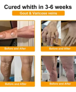 Purelora® BEE VENOM LITHOSPERMUM Pain-Relief Bone Healing Cream