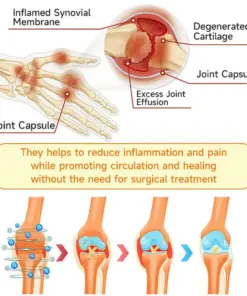 Purelora® Bee Venom Advanced Therapy - Deep Bone Healing & Instant Pain Relief Cream