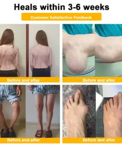 Purelora® Bee Venom Joint Repair Cream