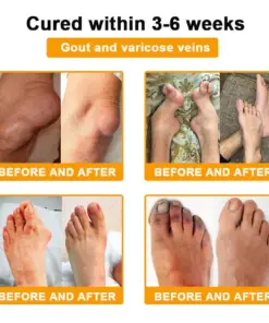 Purelora® Bee Venom Pain Relief Joint Repair Cream