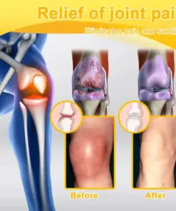 Purelora® Bee Venom Pain Relief Joint Repair Cream