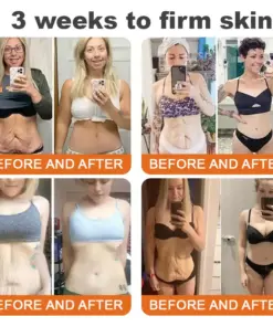 Purelora® Bee Venom Restorative Cream