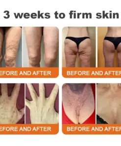 Purelora® Bee Venom Skin Restorative Cream