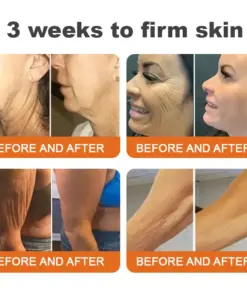 Purelora® Bee Venom Skin Restorative Cream