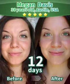 Purelora® Stem Cell–Derived EGF & Copper Peptide Activating Serum