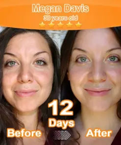 Purelora® Stem Cell Extract EGF and Copper Peptide Revitalizing Essence Cream (deeply activates the skins internal regeneration, making the skin firmer and smoother)