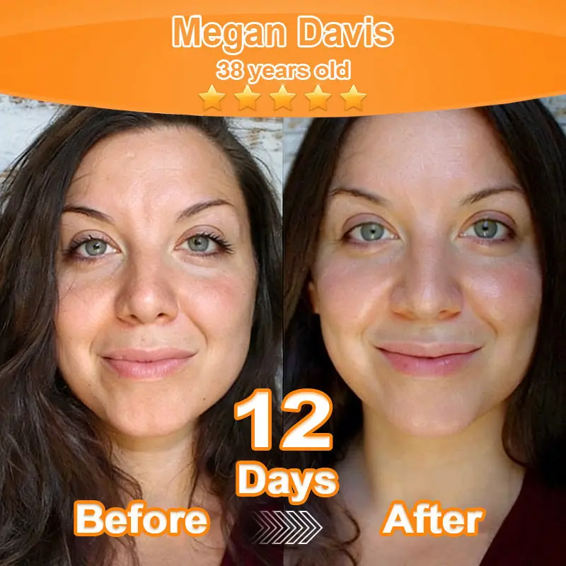 Purelora® Stem Cell Extract EGF and Copper Peptide Revitalizing Essence Cream (deeply activates the skins internal regeneration, making the skin firmer and smoother)