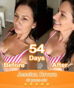 Purelora® Stem Cell Extract EGF and Copper Peptide Revitalizing Essence Cream (deeply activates the skins internal regeneration, making the skin firmer and smoother)