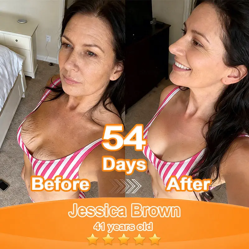 Purelora® Stem Cell Extract EGF and Copper Peptide Revitalizing Essence Cream (deeply activates the skins internal regeneration, making the skin firmer and smoother)