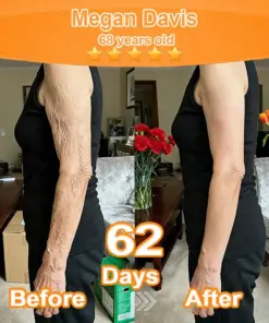 Purelora® Stem Cell Extract EGF and Copper Peptide Revitalizing Essence Cream (deeply activates the skins internal regeneration, making the skin firmer and smoother)