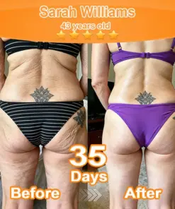 Purelora® Stem Cell Extract EGF and Copper Peptide Revitalizing Essence Cream (deeply activates the skins internal regeneration, making the skin firmer and smoother)