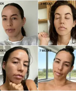 Purelora® Stem Cell Extract EGF and Copper Peptide Revitalizing Essence Cream (deeply activates the skins internal regeneration, making the skin firmer and smoother)