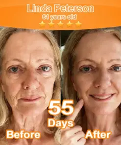 Purelora® Stem Cell Extract EGF and Copper Peptide Revitalizing Essence Cream (deeply activates the skins internal regeneration, making the skin firmer and smoother)