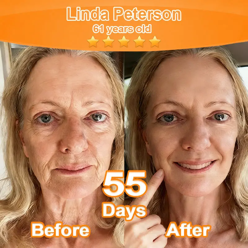 Purelora® Stem Cell Extract EGF and Copper Peptide Revitalizing Essence Cream (deeply activates the skins internal regeneration, making the skin firmer and smoother)