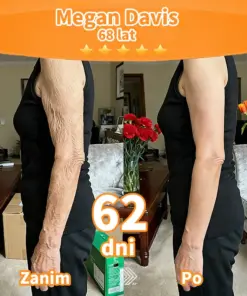 Purelora® Stem Cell Extract EGF and Copper Peptide Revitalizing Essence Cream (głęboko aktywuje wewnętrzną regenerację skóry, sprawia, że staje się ona jędrniejsza i gładsza)