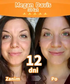 Purelora® Stem Cell Extract EGF and Copper Peptide Revitalizing Essence Cream (głęboko aktywuje wewnętrzną regenerację skóry, sprawia, że staje się ona jędrniejsza i gładsza)