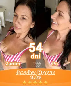 Purelora® Stem Cell Extract EGF and Copper Peptide Revitalizing Essence Cream (głęboko aktywuje wewnętrzną regenerację skóry, sprawia, że staje się ona jędrniejsza i gładsza)