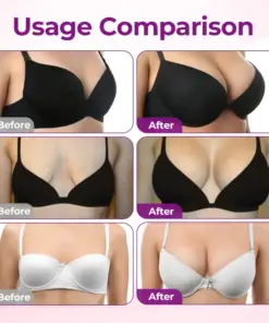 ๐๐ฎ๐ซ๐๐ฅ๐จ๐ซ๐ยฎ Targeted Breast Enhancement Advanced Nano Microneedle Patch