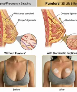 ๐๐ฎ๐ซ๐๐ฅ๐จ๐ซ๐ยฎ Targeted Breast Enhancement Advanced Nano Microneedle Patch