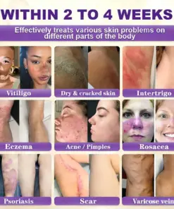 Purelora® Biotin 10-in-1 Skin Repair Cream