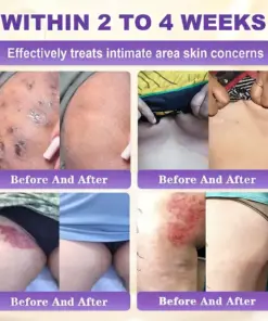 Purelora® Biotin 10-in-1 Skin Repair Cream