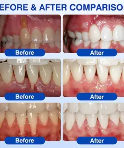 𝐏𝐔𝐑𝐄𝐋𝐎𝐑𝐀® GumRevive Periodontal Repair Gel