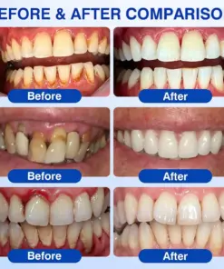 𝐏𝐔𝐑𝐄𝐋𝐎𝐑𝐀® GumRevive Periodontal Repair Gel