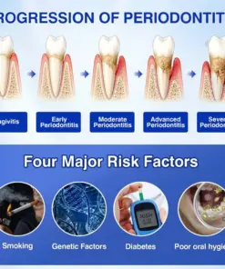 𝐏𝐔𝐑𝐄𝐋𝐎𝐑𝐀® GumRevive Periodontal Repair Gel