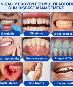 𝐏𝐔𝐑𝐄𝐋𝐎𝐑𝐀® GumRevive Periodontal Repair Gel