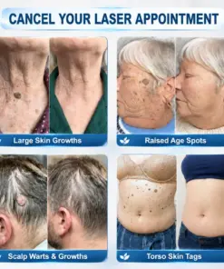 PURELORA® Targeted Skin Tag & Spot Care Cream