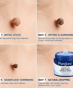 PURELORA® Targeted Skin Tag & Spot Care Cream