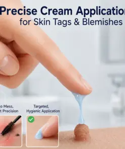 PURELORA® Targeted Skin Tag & Spot Care Cream