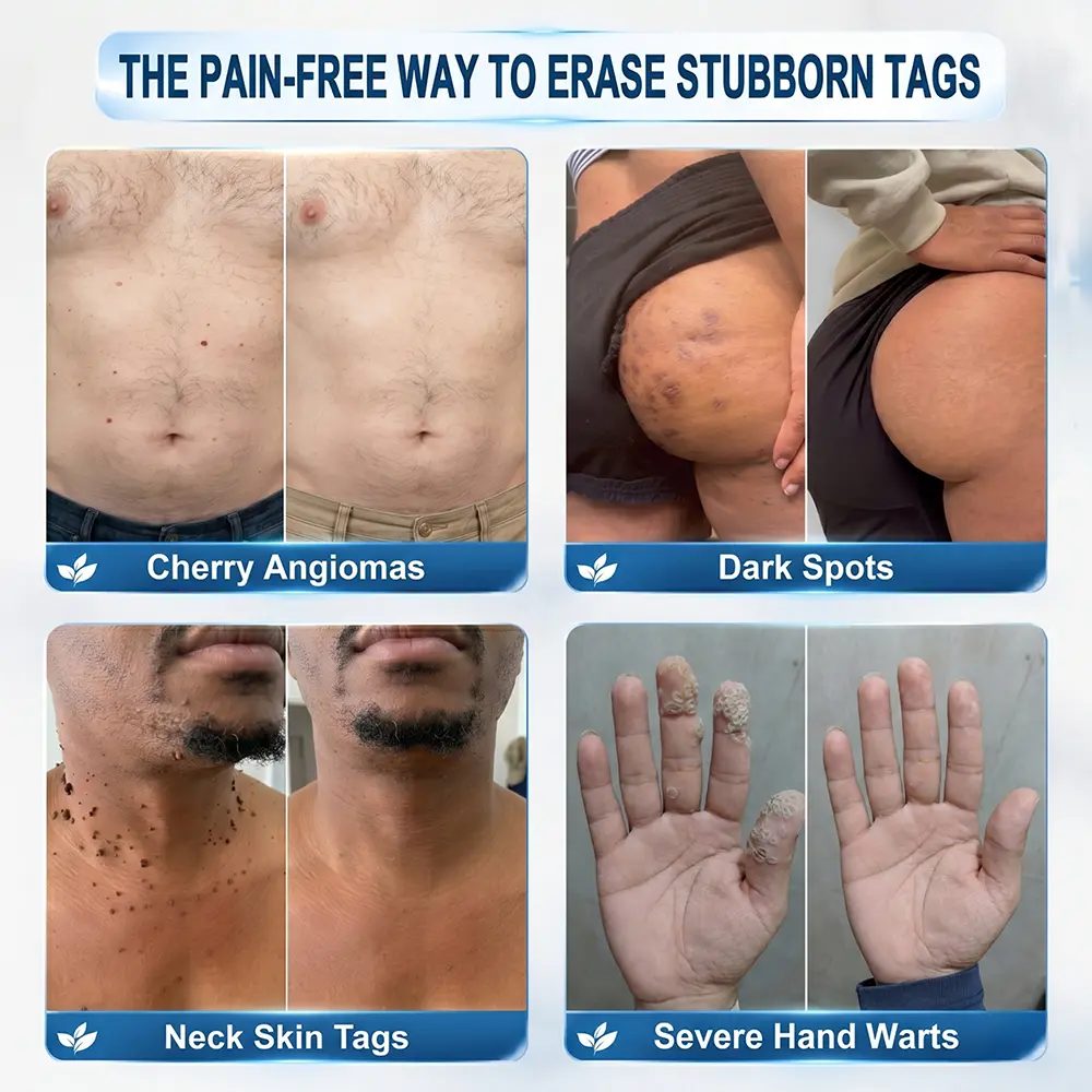 Purelora® 6-in-1 Hydrocolloid Patch