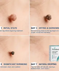 Purelora® 6-in-1 Hydrocolloid Patch