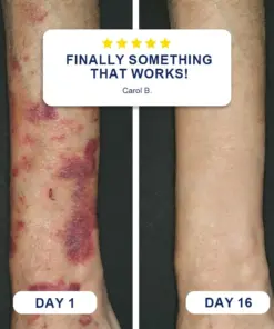 𝐏𝐔𝐑𝐄𝐋𝐎𝐑𝐀® Bruise Repair Cream