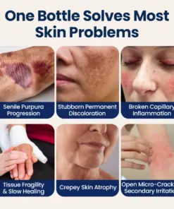 Purelora® ResiliVeil Bruise Appearance Barrier Care Cream